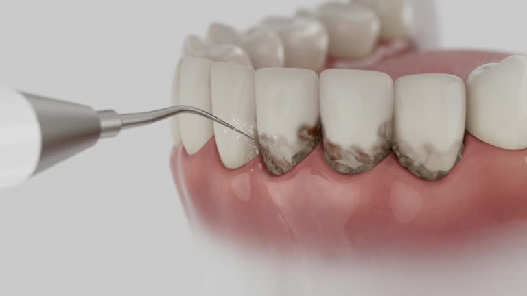 Reliable Dental Implants contractor in West Point, UT by Smile Center Dentistry